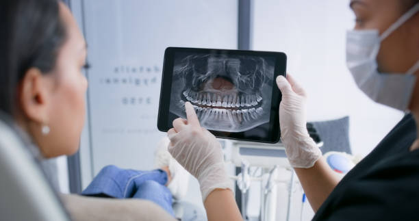 Licensed Tooth Extraction service in Iberville Parish County, LA - Smile Center Dentistry